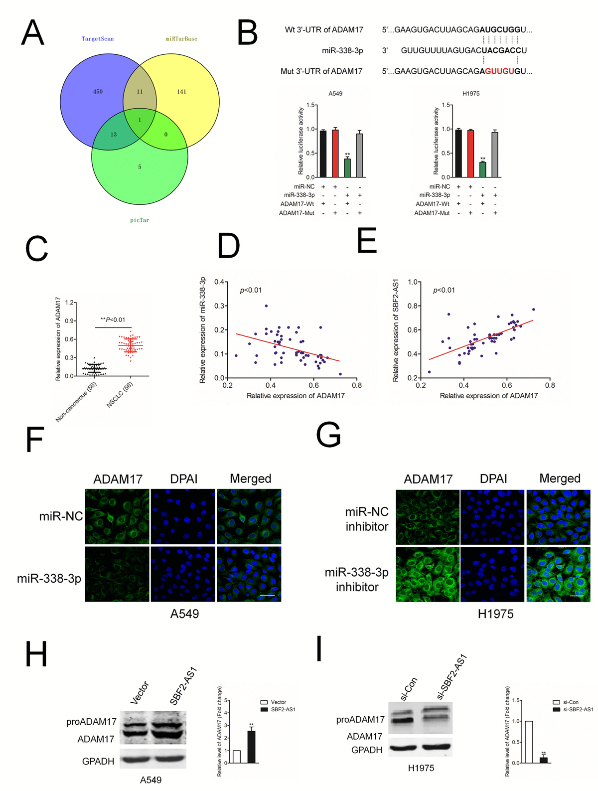 Long Noncoding Rna Sbf2 As1 Contributes To The Growth And Metastatic