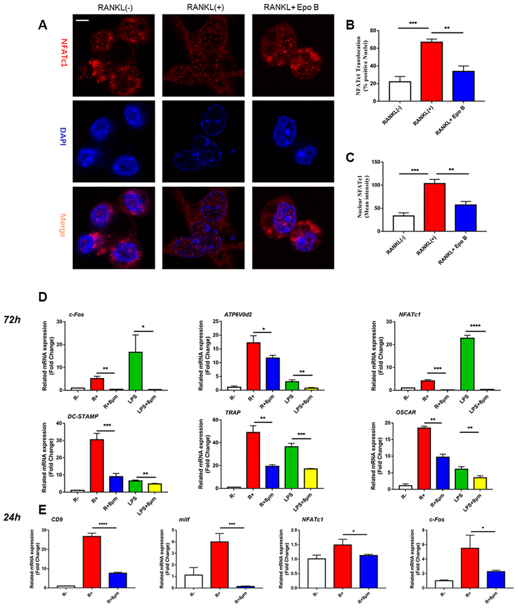 Epothilone B suppressed NFATc1 nuclear translocation and the expression of marker genes during osteoclastogenesis. (A) Representative images of immunofluorescence staining of the nuclear translocation of NFATc1 in the absence of presence of Epothilone B. Scale bar = 800 μm. (B) Quantitative analysis of the percentage of positive cells (NFATc1 translocation from cytosol to nuclear) in all cells. (C) Quantitative analysis of the mean intensity of NFATc1 in the cells nuclear. (D) Relative expression of marker genes in the procedure of osteoclastogenesis from monocytes to mature osteoclasts on mRNA level. (E) Relative expression of marker genes in the early stage of osteoclastogenesis on mRNA level.
