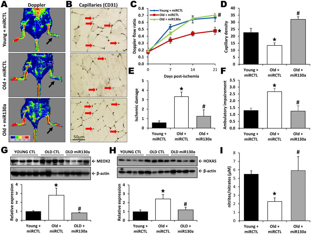 miR-130a treatment rescues age-dependent impairment of neovascularization. Quantification of blood flow recovery (Laser Doppler, A, C), capillary density (CD31 immunostaining, B, D), ischemic damage (E) and ambulatory impairment (F) in young mice treated with a scrambled miR mimic control (miRCTL) or old mice treated with miR-130a mimic (miR-130a) or miRCTL. Arrows indicate left ischemic hindlimbs (A) and capillaries (B). (G, H) Representative Western blots and quantitative analyses of MEOX2 (G) and HOXA5 (H) expression in the ischemic muscles of the three groups of mice. (I) Comparison of NO blood plasma bioavailability in the three groups of mice. Data are mean ± SEM (n=3-7/group). * p