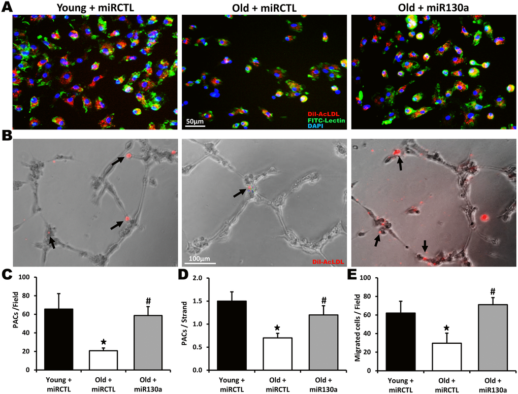 Effect of miR-130a treatment on PAC number and function during aging. Representative pictures and quantification of PAC number (A, C), PAC (red) integration into HUVEC tubules (matrigel assay, B, D) and PAC migration (Boyden chamber assay, E) in young mice treated with a scrambled miR mimic control (miRCTL) or old mice treated with miR-130a mimic (miR-130a) or miRCTL. Triple-stained PACs (DAPI, BS-1 lectin-FITC, and DiI-acLDL) are shown in (A). Data are mean ± SEM (n=4-5/group). * p