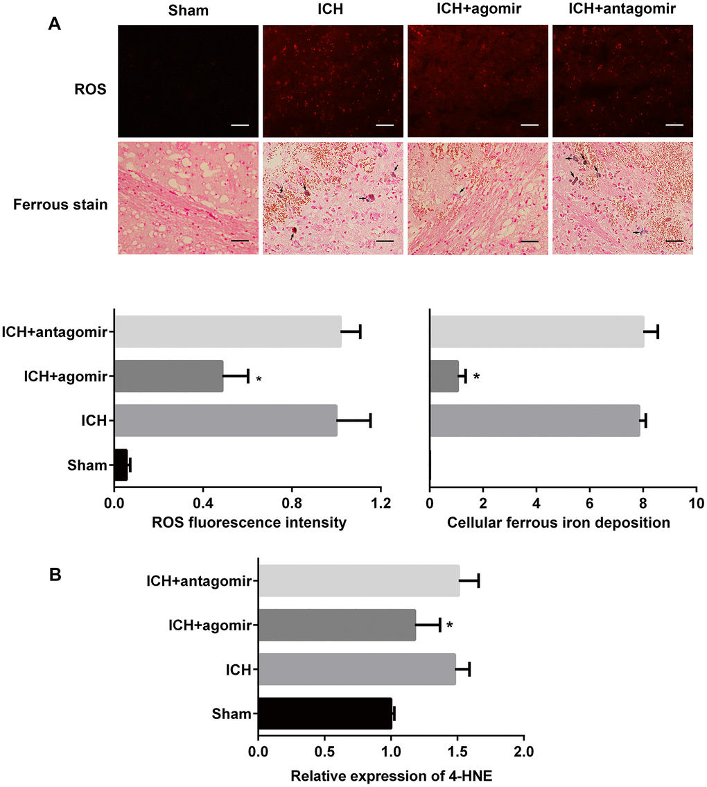 Treatment with miR-183-5p alleviated oxidative damage after intracerebral hemorrhaging (ICH). (A) Representative immunofluorescence images showing hydroethidine-positive reactive oxygen species (ROS) (n = 8/group) and ferrous deposition stained with Lillie dye (n = 8/group) in different groups at 3 days after ICH. Arrows indicate ferrous deposition in cells. Quantitative analysis of ROS fluorescence intensity and ferrous deposition in cells corresponding to the above are shown below. Scale bars = 50 μm. (B) Quantitative analysis of 4-HNE in the brains of mice from different groups at 3 days after ICH. n = 8/group. Values are presented as the mean ± standard deviation. *P 