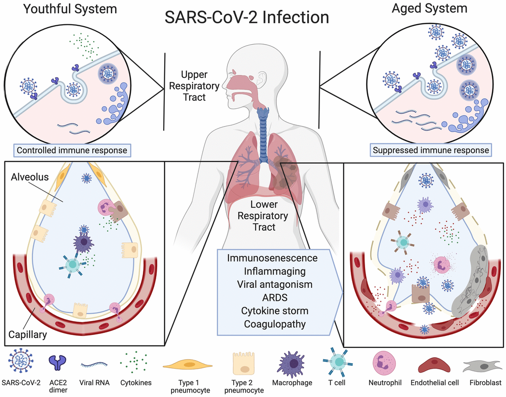 Ineffective clearance of SARS-CoV-2 infection in the aged respiratory system. The SARS-CoV-2 virus binds to ACE2 enzymes on airway epithelial cells in the upper respiratory tract where they are endocytosed and replicated (top left), alerting the immune system. Viruses then travel to the alveoli and infect type 2 pneumocytes which, in the youthful system (lower left), are recognized by alveolar macrophages (AMs) or dendritic cells (not pictured) that release cytokines and present antigens to T cells and other adaptive immune cells. T cells with the appropriate receptors activate other lymphocytes or directly kill infected cells, preventing the spread of the virus. Neutrophils migrate to the sites of infection to clear infected cell debris. In the aged system (top right), viral alert signals are initially slow, resulting in greater viral replication. Defective macrophages and T cells with a limited repertoire of receptors are less effective (lower right). More cells are infected, inducing high levels of inflammatory cytokine signaling. The endothelial cell lining of the capillary becomes inflamed, fibroblasts are activated, and SARS-CoV-2 viral components and cytokines enter the bloodstream. Fluid fills the alveolus, reducing lung capacity and the virus infects microvascular pericytes in other organs. A cytokine storm initiates microvasculature clotting, causing severe hypoxia, coagulopathy and organ failure. Created with BioRender.