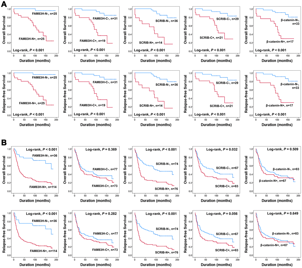 Survival analysis according to the expression of FAM83H, SCRIB, and β-catenin in early gastric cancers and advanced gastric cancers. Kaplan-Meier survival curves for overall survival and relapse-free survival in 50 early gastric cancers (A) and 150 advanced gastric cancers (B).