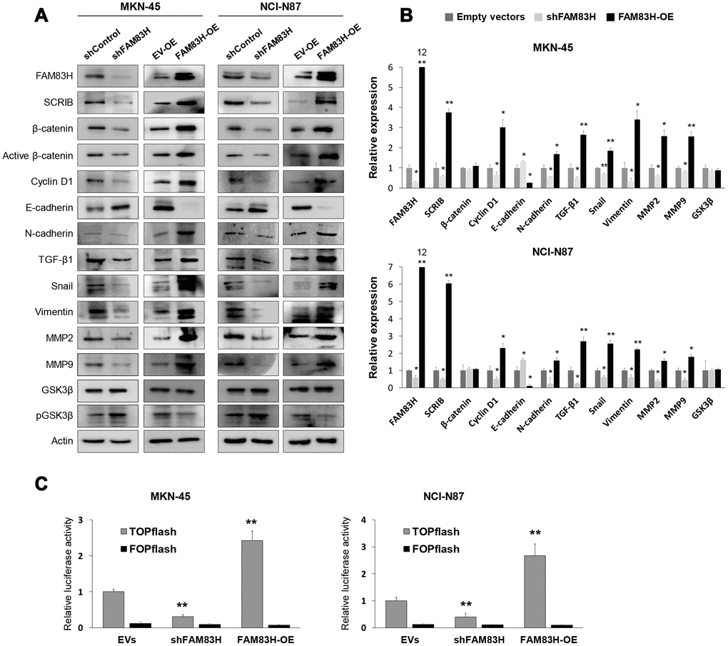 Western blot, quantitative reverse-transcription polymerase chain reaction, and luciferase reporter assay after knock-down or overexpression of FAM83H in gastric cancer cells. (A) Western blot was performed for FAM83H, SCRIB, β-catenin, active β-catenin, cyclin D1, E-cadherin, N-cadherin, TGF-β1, snail, vimentin, MMP2, MMP9, GSK3β, phosphorylated GSK3β, and actin after knock-down or overexpression of FAM83H in MKN-45 and NCI-N87 gastric cancer cells. (B) Quantitative reverse-transcription polymerase chain reaction was performed for FAM83H, SCRIB, β-catenin, cyclin D1, E-cadherin, N-cadherin, TGF-β1, snail, vimentin, MMP2, MMP9, and GSK3β after knock-down or overexpression of FAM83H in MKN-45 and NCI-N87 gastric cancer cells. (C) TOPflash luciferase reporter assay was performed by transfecting TOPflash or FOPflash plasmid DNA with pRL-TK Renilla Luciferase plasmid DNA in MKN-45 and NCI-N87 cells with induction of knock-down or overexpression of FAM83H. *; P P 