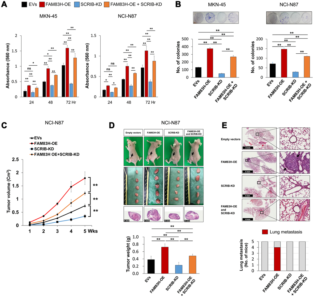 The combined effect of overexpression of FAM83H and knock-down of SCRIB on the proliferation and tumor formation of gastric cancer cells. (A, B) The effect of overexpression of FAM83H and/or knock-down of SCRIB on the proliferation of MKN45 and NCI-N87 gastric cancer cells were evaluated with an MTT assay (A) and a colony-forming assay (B). The MTT assay was performed after seeding 3,000 cells per well of a 96-well plate. The colony-forming assay was performed by plating 1,000 cells per well in a 6-well plate for ten days. The number of colonies was determined with GeneTools analysis software. (C, D) In vivo tumor growth was evaluated by subcutaneously implanting 2x106 NCI-N87 cells with overexpression of FAM83H and/or knock-down of SCRIB. The tumor volume was measured every week after tumor implantation by the equation V = LxWxHx0.52 mm3 (C). At five weeks after tumor inoculation, the mice were euthanized and tumor weight was measured (D). (E) The mice were evaluated for metastasis and histologic findings of the lung. The arrows indicate metastatic NCI-N87 cells in lung. *; P P 
