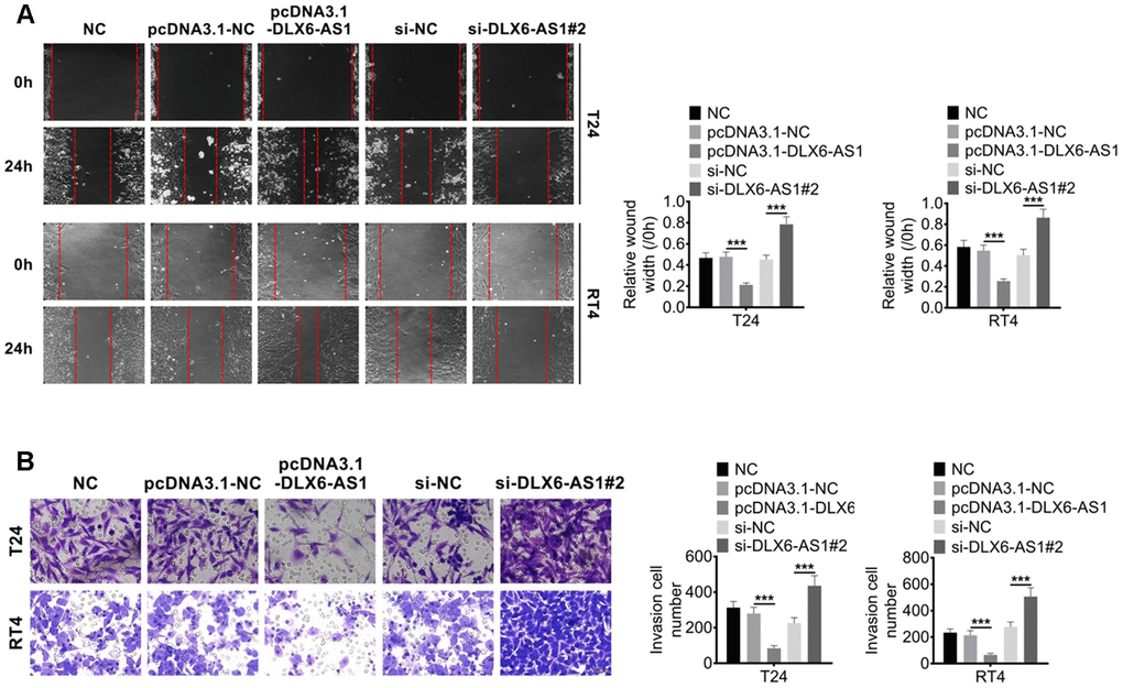 DLX6-AS1 promotes migration and invasion of BC cells. (A) The migration of BC cells with pcDNA3.1-DLX6-AS1 or sh-DLX6-AS1 transfection was determined by wound healing assay (B) The invasion of BC cells with pcDNA3.1-DLX6-AS1 or sh-DLX6-AS1 transfection was determined by Transwell chamber assay. Data were expressed as the mean ± SD, n = 3. ***P 