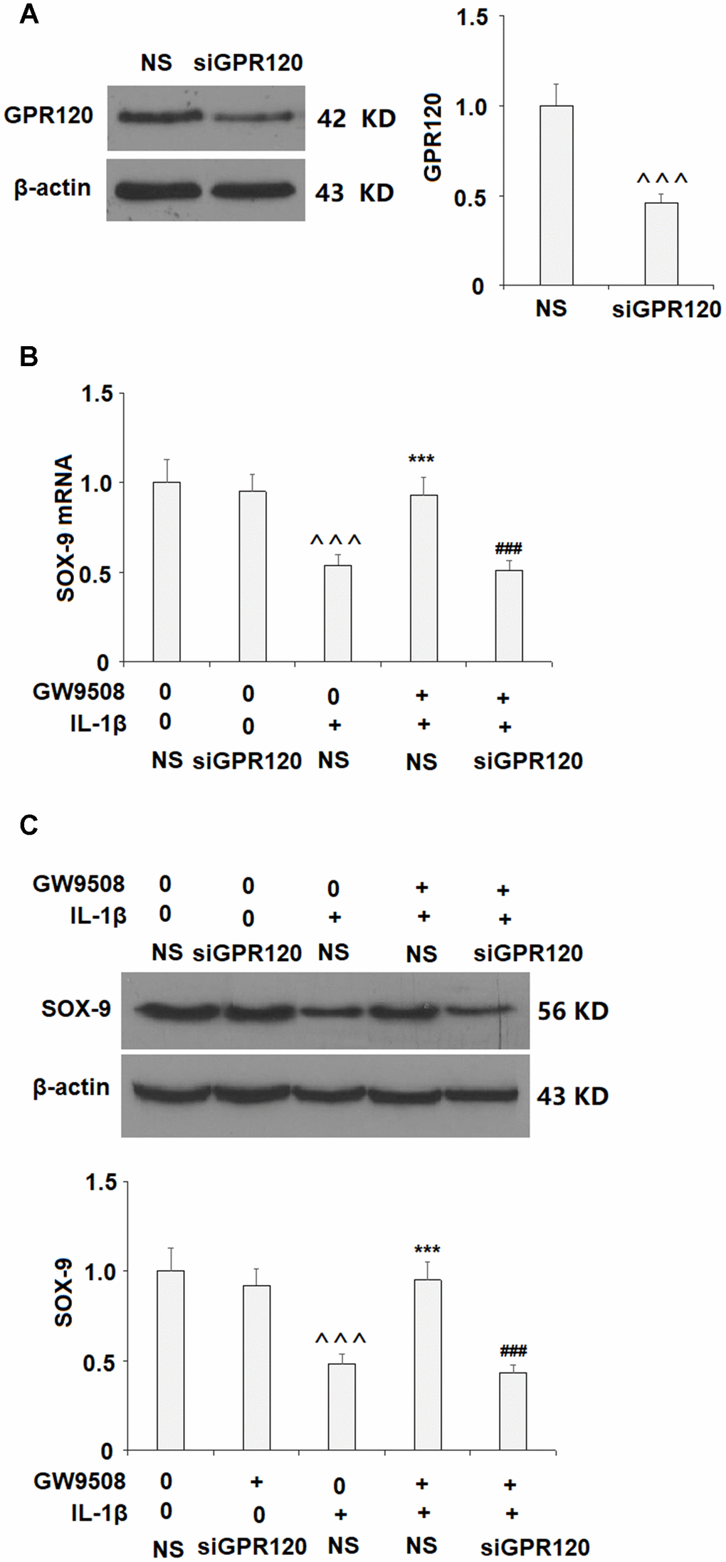 Knockdown of GPR120 abolished the protective effects of GW9508 on the expression of SOX-9. Cells were transfected with non-specific siRNA (NS) or GPR120 siRNA (siGPR120) for 24 h, followed by stimulation with or without GW9508 (50 μM) for 24 h. (A) Western blot analysis revealed the successful knockdown of GPR120. (B) SOX-9 mRNA; (C) SOX-9 protein (^^^, P