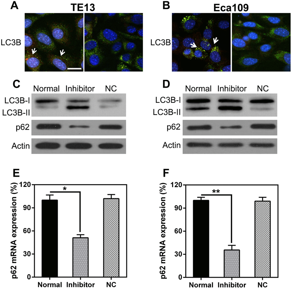 miR-126 depletion leads to autophagy. (A, B) TE13 and Eca109 cells were plated onto 24-well plates and treated with GFP-LC3 plus either the miR-126 or NC-inhibitor for 36 h before harvesting. GFP-LC3B was assessed using IFA (magnification, × 400). (C, D) WB analysis of LC3B and p62 protein expression in cells after miR-126 silencing. (E, F) qPCR analysis of p62 mRNA expression after miR-126 silencing in TE13 and Eca109 cells. Results are displayed as the average ± SD. *P P P 
