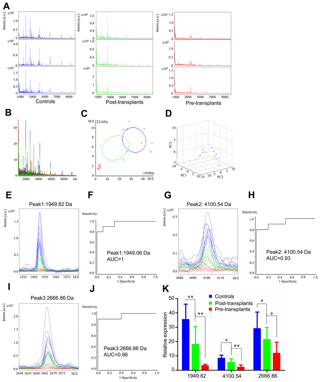Serum proteomic profiling analysis for perioperative group, healthy controls (blue), paired post-transplant patients (green) and pre-transplant patients (red). (A) Representative mass spectra of three samples in healthy controls, post-transplant patients and pre-transplant patients in the mass range from 1000 to 10,000 Da. (B) Overall sum of the spectra in the mass range from 1000 to 10,000 Da obtained from perioperative group described above. (C) Bivariate plot of perioperative group with the most differentiated two peaks (m/z: 2216, 1950). (D) 3D plot of perioperative group. (E, G, I) Comparison of the spectra of three peaks in healthy controls, post-transplant patients and pre-transplant patients. (F, H, J) ROC curves for three selected peaks with their AUC values. (K) Average expression levels of three selected peaks in healthy controls, post-transplant patients and pre-transplant patients and their respective p-values. Values are expressed as mean ± SD. (***p p p 