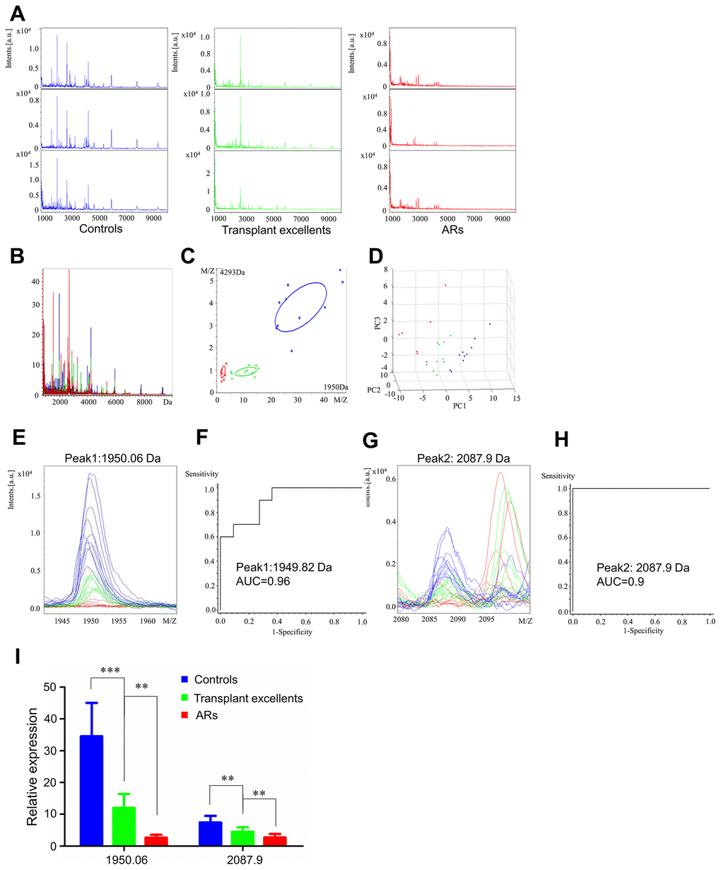 Serum proteomic profiling analysis for AR group, healthy controls (blue), transplant excellent patients (green) and AR patients (red). (A) Representative mass spectra of three samples in healthy controls, transplant excellent patients and AR patients in the mass range from 1000 to 10,000 Da. (B) Overall sum of the spectra in the mass range from 1000 to 10,000 Da obtained from AR group described above. (C) Bivariate plot of AR group with the most differentiated two peaks (m/z: 4293, 1950). (D) 3D plot of AR group. (E, G) Comparison of the spectra of two peaks in healthy controls, transplant excellent patients and AR patients. (F, H) ROC curves for two selected peaks with their AUC values. (I) Average expression levels of two selected peaks in healthy controls, transplant excellent patients and AR patients and their respective p-values. Values are expressed as mean ± SD. (***p p p 