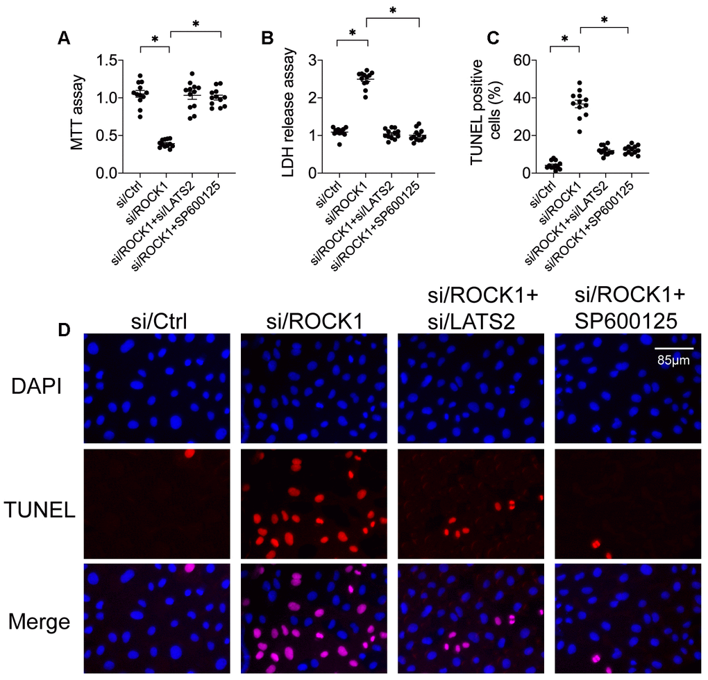 Inactivation of the LATS2-JNK pathway abolishes the tumor-suppressive effects of ROCK1 knockdown. (A) MTT assay of cell viability. siRNA against LATS2 (si/LATS2) and SP600125 were used inhibit LATS2 upregulation and JNK activation, respectively. (B) An LDH release assay was used to measure LDH levels in the medium. (C, D) TUNEL staining was used to quantify numbers of apoptotic cells after si/LATS2 transfection and SP600125 administration. *p