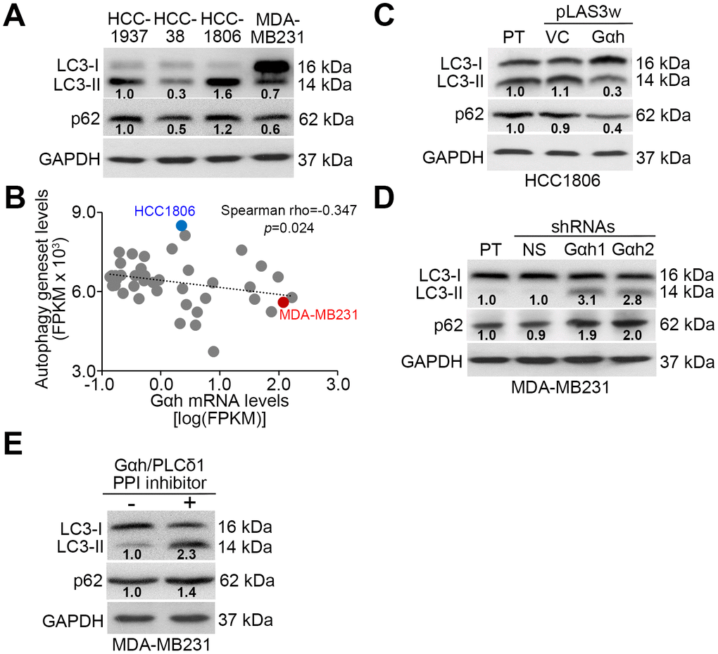 The Gαh-PLC-δ1 axis promotes autophagosome degradation in TNBC cells. (A) Results from the Western blot analysis for LC3-I/II, p62 and GAPDH proteins derived from the indicated TNBC cell lines. (B) Correlation of mRNA expression levels of Gαh and the autophagy-related gene set in a panel of breast cancer cell lines derived from the Cancer Cell Line Encyclopedia (CCLE) database. Spearman’s correlation test was used to estimate the statistical significance. (C–E) Results from the Western blot analysis of the LC3-I/II, p62 and GAPDH proteins derived from the parental (PT) HCC1806 cells without (vector control, VC) or with Gαh overexpression (C) and the parental MDA-MD231 cells without (nonsilenced, NS) or with Gαh knocked down using two independent shRNA clones (D), and MDA-MD231 cells treated without or with 10 μM Gαh/PLC-δ1 protein-protein interaction (PPI) inhibitor for 2 hours (E). In A, C, D, E, GAPDH was used as an internal control of protein loading. The protein intensities of representative blots from three independent experiments were normalized by GAPDH levels and presented as a ratio to the control group.