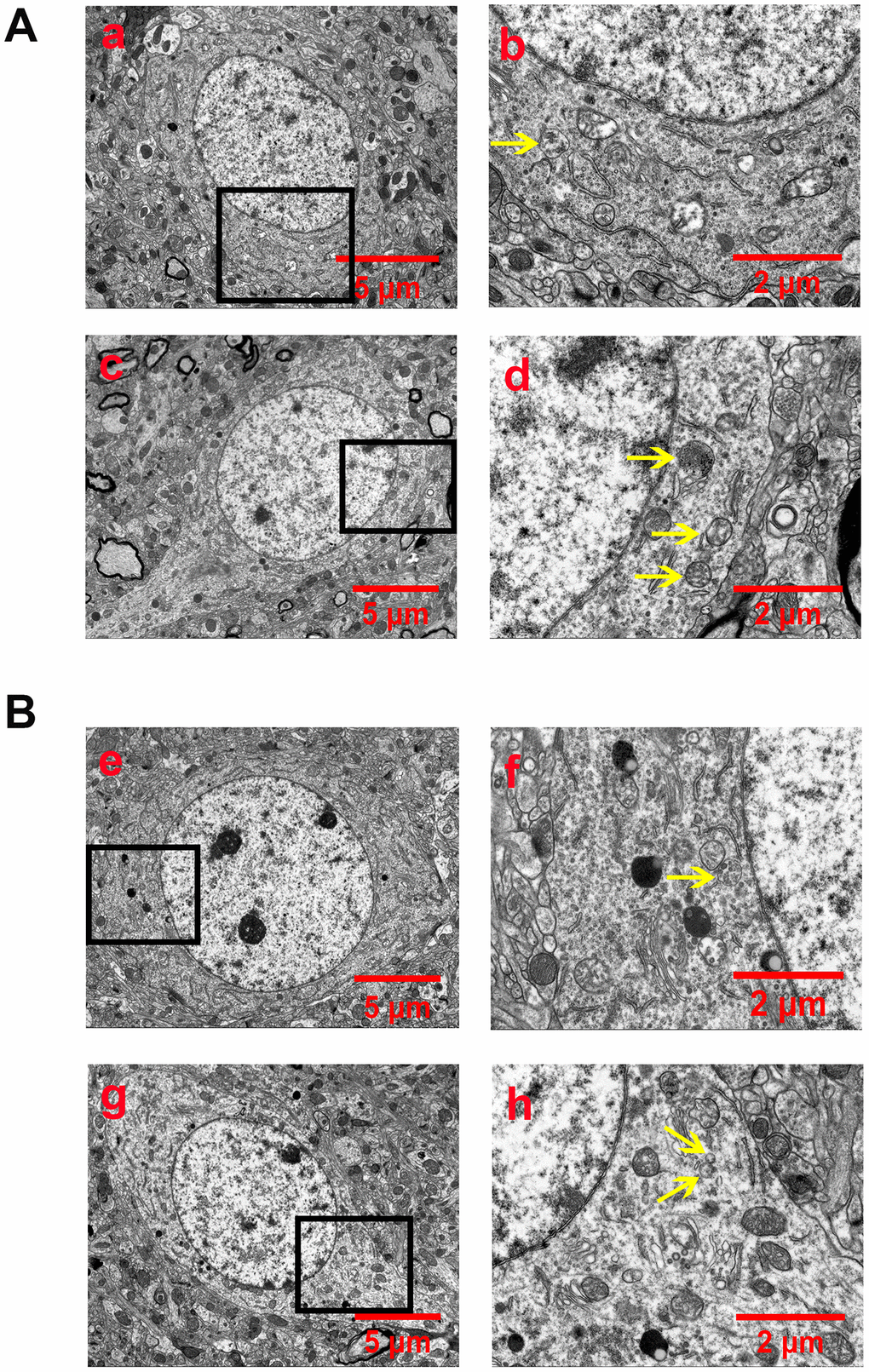 EA pretreatment inhibited the formation of autophagosomes and autophagolysosomes (yellow arrow) in cortical neurons of rats with CIR injury. (A) Autophagosomes and autophagolysosomes in neurons of the peri-ischemic cortex in the sham group (a and b) and the I/R group (c and d). (B) Autophagosomes and autophagolysosomes in neurons of the peri-ischemic cortex in the I/R + EA group (e and f) and the I/R + EA + EX527 group (g and h). The images of b, d, f, and h indicated the enlarged area of the squares in a, c, e, and g, respectively. Scale bar: a, c, e, g, 5 μm; b, d, f, h, 2 μm.