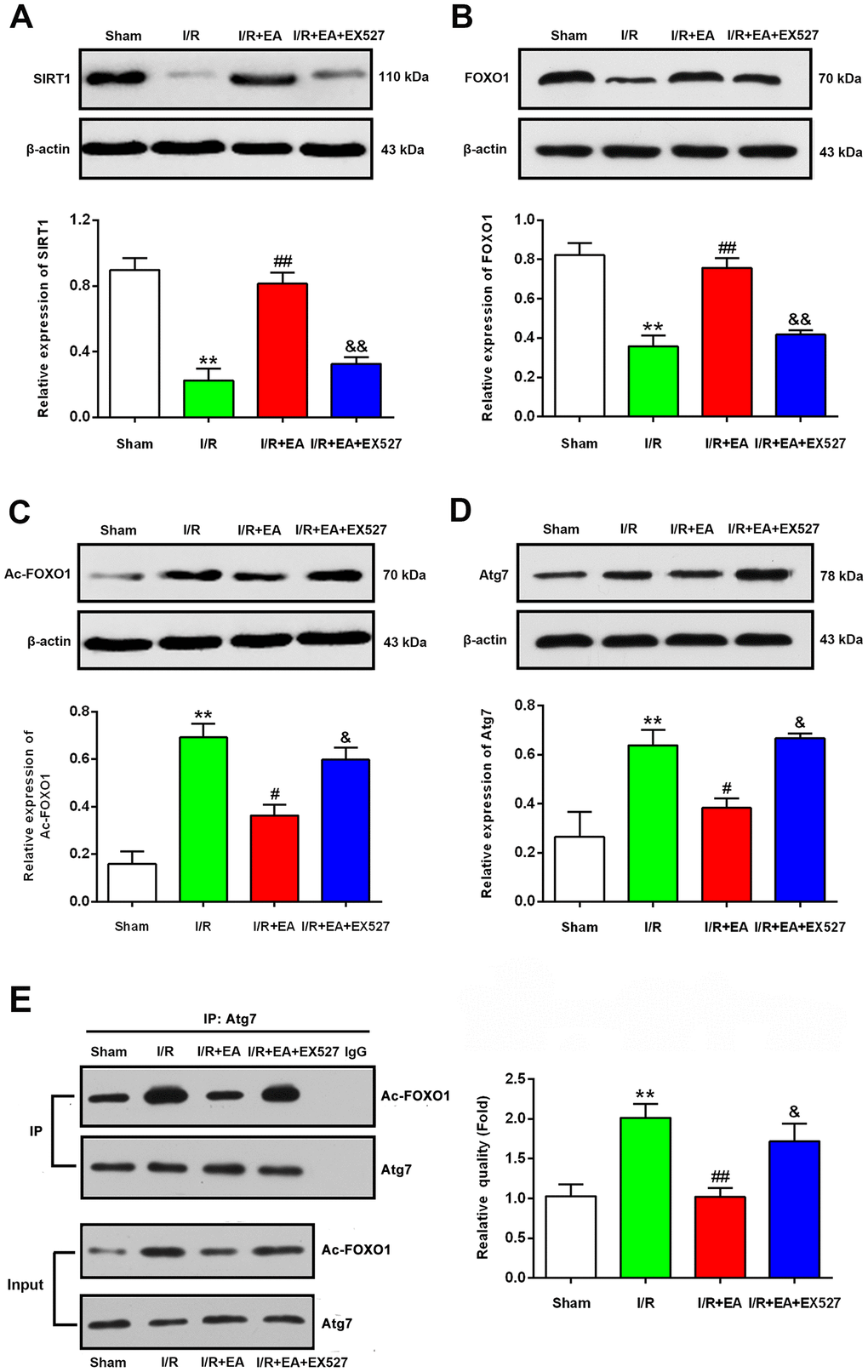 EA pretreatment up-regulated the protein levels of SIRT1, FOXO1, down-regulated the protein levels of Ac-FOXO1 and Atg7 in the peri-ischemic cortex after 24 h of reperfusion. (A) Protein band and relative expression of SIRT1 in the peri-ischemic cortex. (B) Protein band and relative expression of FOXO1 in the peri-ischemic cortex. (C) Protein band and relative expression of Ac-FOXO1 in the peri-ischemic cortex. (D) Protein band and relative expression of Atg7 in the peri-ischemic cortex. (E) Co-IP between Atg7 and Ac-FOXO1 in the peri-ischemic cortex and the relative quality of Ac-FOXO1 after normalization with Atg7, and input results of Atg7 and Ac-FOXO1. β-actin was used as a loading control. Data were presented as the mean ± SEM (n=3). **Pvs. sham group. #P##Pvs. I/R group; &P&&Pvs. I/R + EA group.
