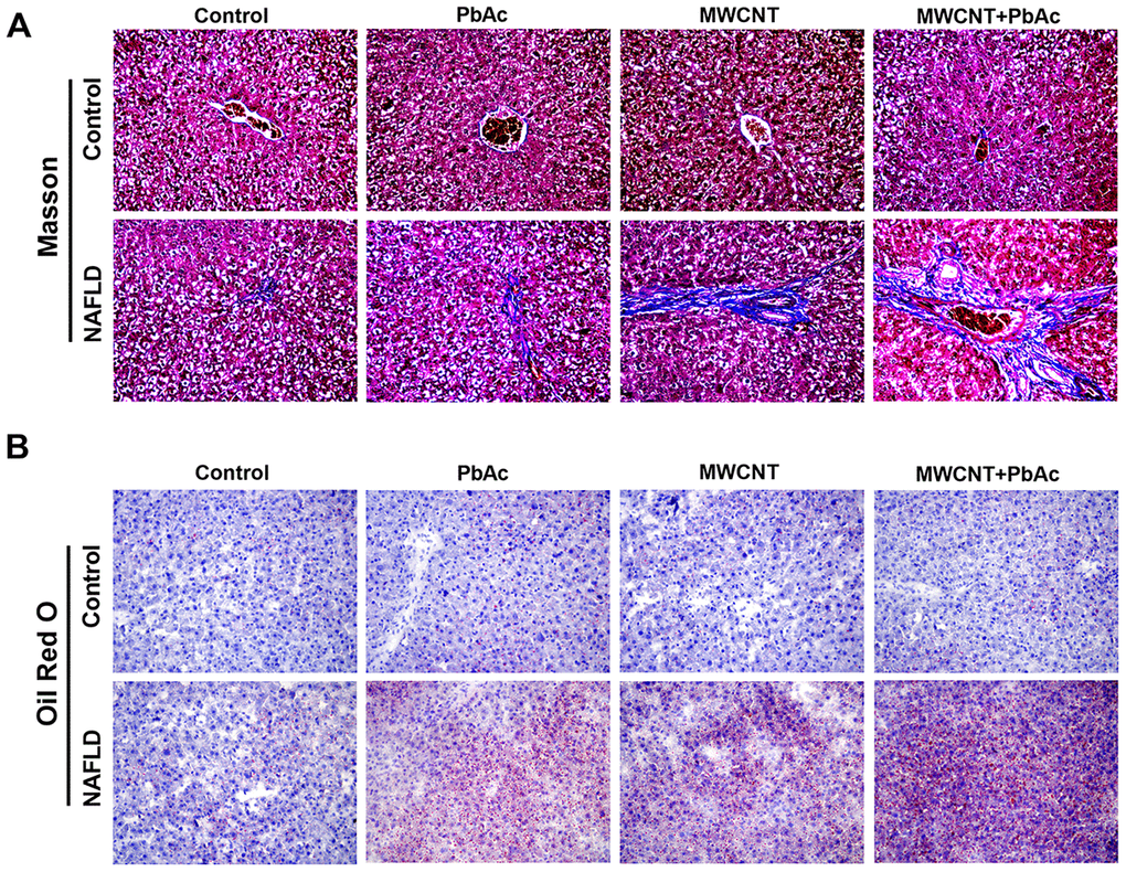 MWCNTs and PbAc exposure significantly aggravated the hepatic fibrosis and steatosis in NAFLD mice. (A) Upon the low dose of PbAc, MWCNTs or MWCNTs + PbAc administration, Masson staining was conducted to detect the collagen deposition (blue indicates collagen) in liver tissues of control and NAFLD mice. (B) Oil red O staining was performed to detect the lipidoses (red indicates lipid) in liver tissues of control and NAFLD mice.