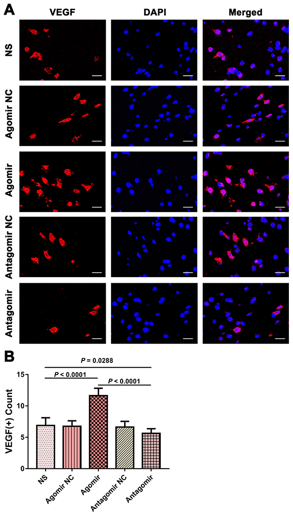 Expression of VEGF in the brain tissues from each group. (A) Immunofluorescence results showing VEGF expression in the brain tissues from each group. Bar = 20 μm. (B) Quantification of VEGF(+) cells in brain tissue (n = 8). VEGF: vascular endothelial growth factor.