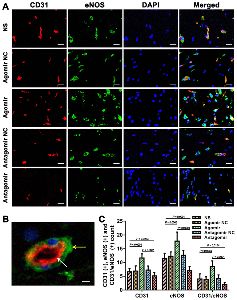 Immunofluorescence results showing the level of CD31 and eNOS expression in the brain tissues from each group. (A) Dual immunofluorescence staining showing CD31(+) and eNOS(+) cells in the ischemic brains in each group. Bar = 20 μm. (B) Representative dual immunofluorescence staining showing both CD31(+) and eNOS(+) cells. Bar = 5 μm. The white arrow indicates a CD31(+) cell, and the yellow arrow indicates an eNOS(+) cell. (C) Counts of CD31(+), eNOS(+) and CD31/eNOS(+) cells in each group. The error bars represent the ±SDs. eNOS: endothelial nitric oxide synthase.