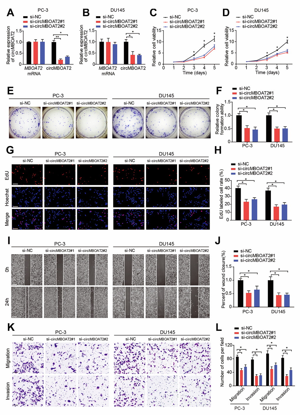 circMBOAT2 promotes cell proliferation, migration, and invasion in vitro. (A, B) qRT-PCR analysis of circMBOAT2 and MBOAT2 expression in PC-3 and DU145 cells treated with circMBOAT2 siRNAs. (C, D) CCK-8 assay determined the cell viability in PC-3 and DU145 cells treated with circMBOAT2 siRNAs. (E, F) Representative images and quantifications of colony formation assays in PC-3 and DU145 cells treated with circMBOAT2 siRNAs. (G, H) Representative images and quantifications of EdU assays in PC-3 and DU145 cells treated with circMBOAT2 siRNAs. Scale bars: 100 μm. (I, J) Representative images and quantifications of wound healing assays in PC-3 and DU145 cells treated with circMBOAT2 siRNAs. Scale bars: 200 μm. (K, L) Representative images and quantification of transwell assays in PC-3 and DU145 cells treated with circMBOAT2 siRNAs. Scale bars: 100 μm. Data are displayed as mean ± SD. *p p 