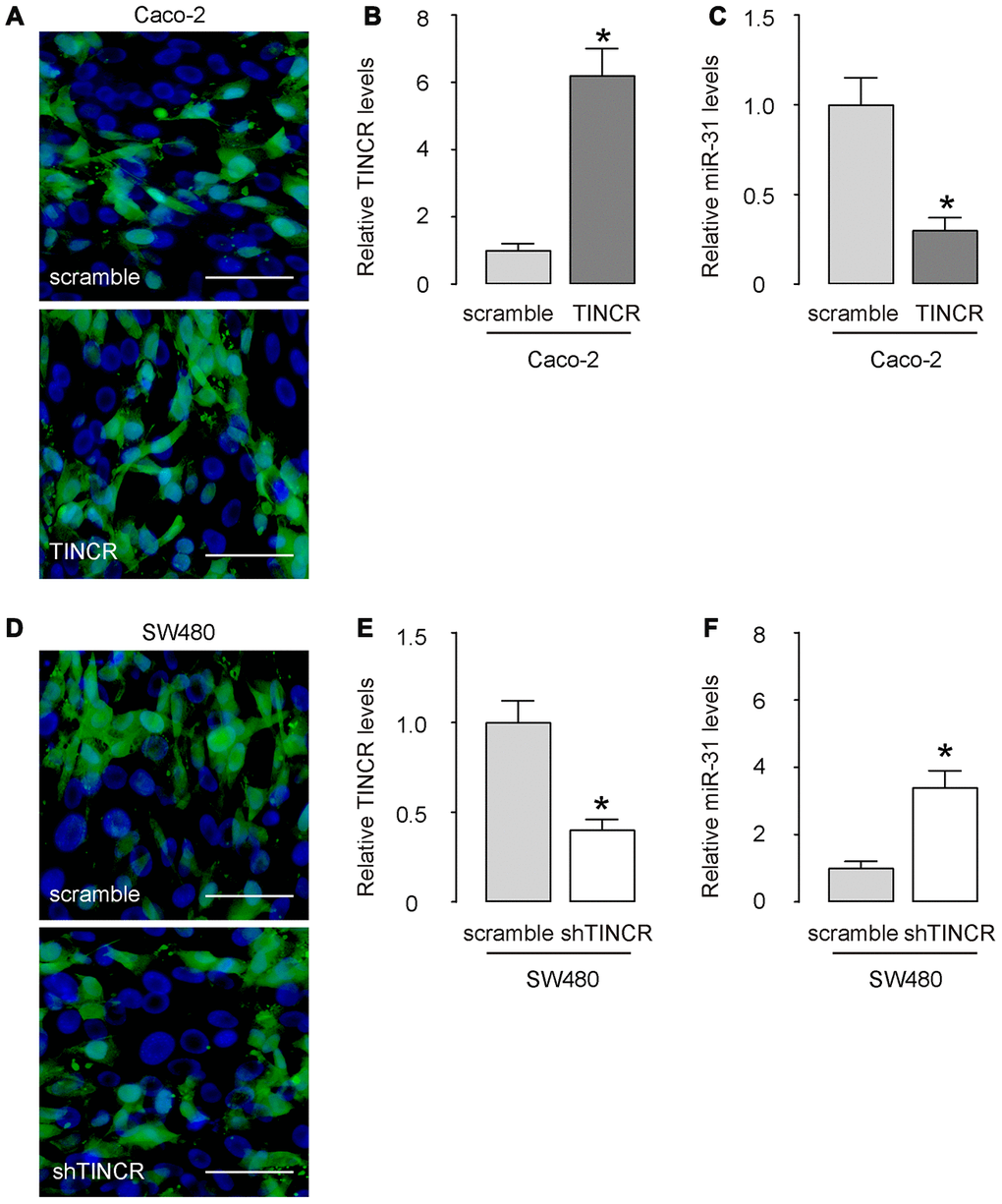 Overexpression or depletion of TINCR in CRCs. (A–C) Transfection with TINCR or scramble in Caco-2 cells, shown by representative cell images in culture (A), and by RT-qPCR for TINCR (B) and for miR-31 (C). (D, E) Transfection with shTINCR or scramble in SW480 cells, shown by representative cell images in culture (D), and by RT-qPCR for TINCR (E) and for miR-31 (F). N=5. *p