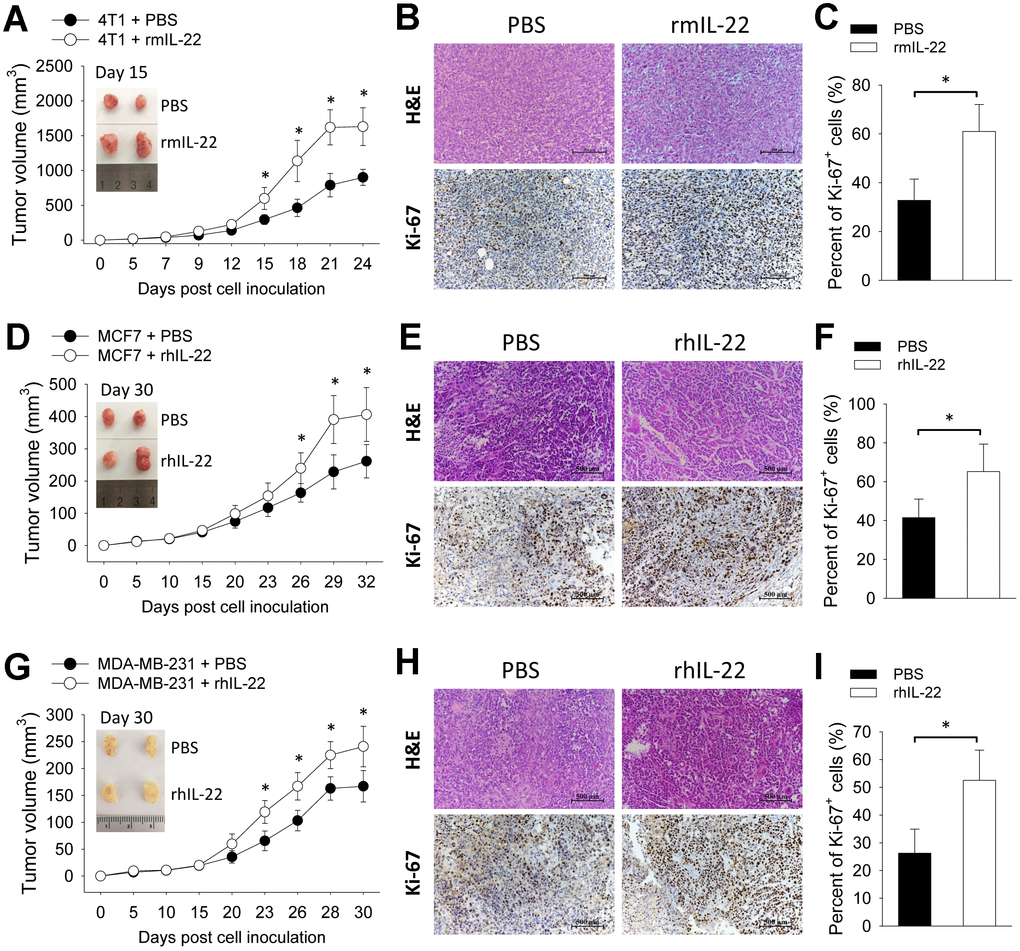 IL-22 promotes growth of breast cancer cells in vivo. (A–C) 4T1 cells (2×105) were injected into a single mammary fat pad of BALB/c mice (n=6). (D–F) MCF7 cells (2×106) and (G–I) MDA-MB-231 cells (2×106) were inoculated subcutaneously to BALB/c Nude mice (n=6). From day 3 post cell inoculation, mice were injected with PBS or recombinant murine IL-22 (rmIL-22, 20 μg/kg) or recombinant human IL-22 (rhIL-22, 20 μg/kg) thrice weekly for up to 3 weeks. (A, D, G) Tumor size was measured continuously. (B, E, H) 4T1 tumors were collected on day 15. MCF7 and MDA-MB-231 tumors were collected on day 30. Histological analyses were performed by H&E staining and Ki-67 immunohistochemical staining. Scale bar: 500 μm. (C, F, I) Percent of Ki-67-positive cells were counted (n=4). Data are from two independent experiments. Data are presented as mean ± SD, compared using unpaired t test. *p 
