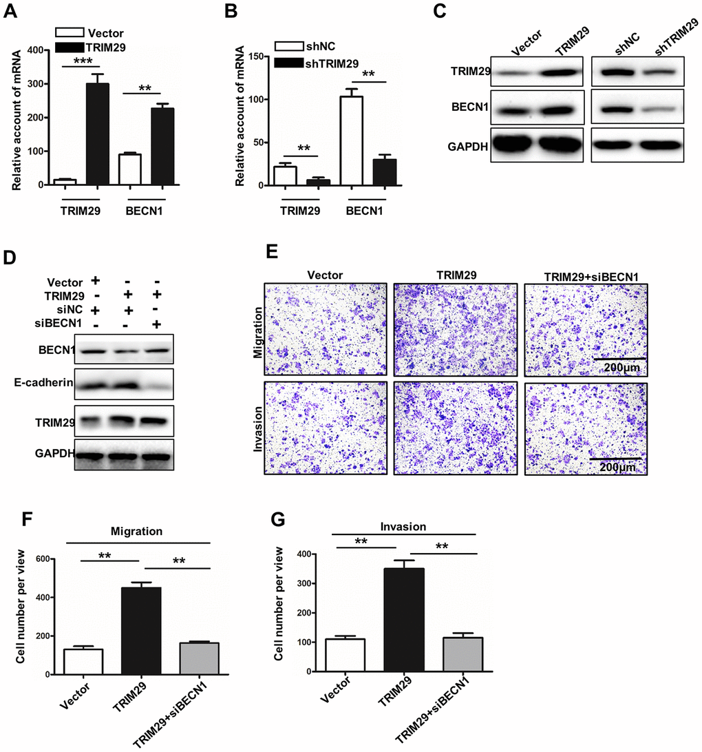 Inhibition of BECN1-induced autophagy leads to the disappearance of TRIM29-promoting phenotype. (A) qRT-PCR analysis of the TRIM29 and BECN1 expressions in TRIM29 over-expression treated HTB-182 cells. (B) qRT-PCR analysis of the TRIM29 and BECN1 expressions in TRIM29 knockdown treated NCI-H1915 cells. (C) Western blot analysis of TRIM29 and BECN1 expressions in TRIM29 over-expression treated HTB-182 cells and TRIM29 knockdown treated NCI-H1915 cells. (D) Western blot analysis BECN1, E-cadherin, and TRIM29 in TRIM29 over-expression treated HTB-182 cells with BECN1 knockdown treatment. (E) Migration and invasion analysis of HTB-182 cells with vector, TRIM29 over-expression, and TRIM29 over-expression+knockdown BECN1 treatment. (F) migration analysis of the number of HTB-182 cells with vector, TRIM29 over-expression, and TRIM29 over-expression+knockdown BECN1 treatment. (G) Invasion analysis of the number of HTB-182 cells with vector, TRIM29 over-expression, and TRIM29 over-expression+knockdown BECN1 treatment. **P