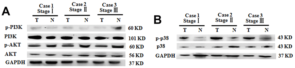 Increased p38 phosphorylation in BC tumoral tissues of patients with different clinical stages. (A) P-PI3K and p-AKT expression in BC tumoral tissues (T) and BC-adjacent non-tumoral tissues (N). (B) Phosphorylation levels of p38 in BC tumoral tissues (T) and BC-adjacent non-tumoral tissues (N). Equal protein loading in all lanes was confirmed by probing the blots with anti- GAPDH antibody. Two independent experiments were performed.