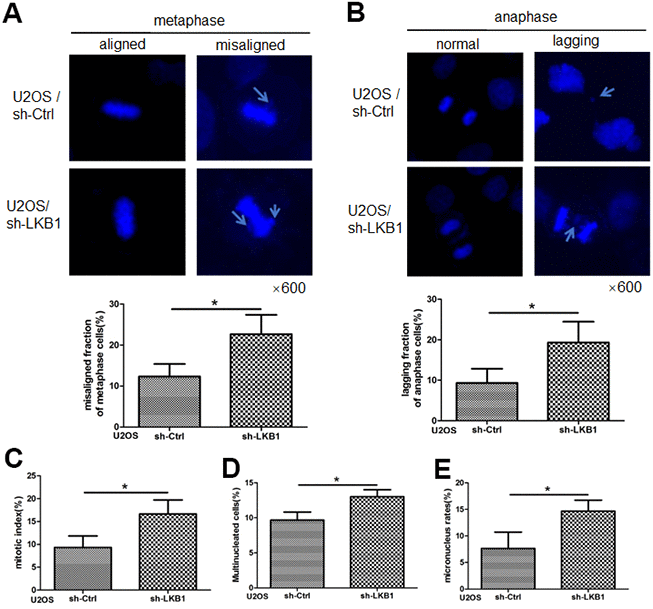LKB1 maintains genome stability in U2OS cells. (A) DAPI staining showing accumulation of misaligned chromosomes at metaphase in U2OS/sh-Ctrl and U2OS/sh-LKB1 cells and corresponding data quantification. (B) DAPI staining showing accumulation of lagging chromosomes at anaphase in U2OS/sh-Ctrl and U2OS/sh-LKB1 cells and corresponding data quantification. (C) Quantification of mitotic index based on p-H3 (Ser10) staining. (D) Quantification of multinucleated cells. Cells with 2 or more nuclei were counted. (E) Quantification of micronucleated cells. Chromosome segregation defects were recorded in 100 randomly selected mitoses from each experiment (n=3). Data are mean ± SD; *P