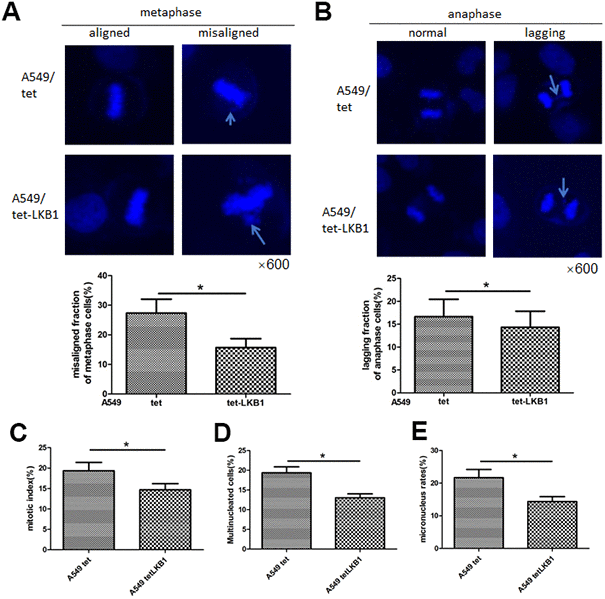 LKB1 improves genome stability in LKB1-deficient A549 cells. (A) DAPI staining showing accumulation of misaligned chromosomes at metaphase in A549 cells and corresponding data quantification. (B) DAPI staining showing accumulation of lagging chromosomes at anaphase in A549 cells and corresponding data quantification. (C) Mitotic index quantification based on p-H3 (Ser10) staining. (D) Quantification of multinucleated cells. (E) Quantification of micronucleated cells. Chromosome segregation defects were recorded in 100 randomly selected mitoses from each experiment (n=3). Data are mean ± SD; *P