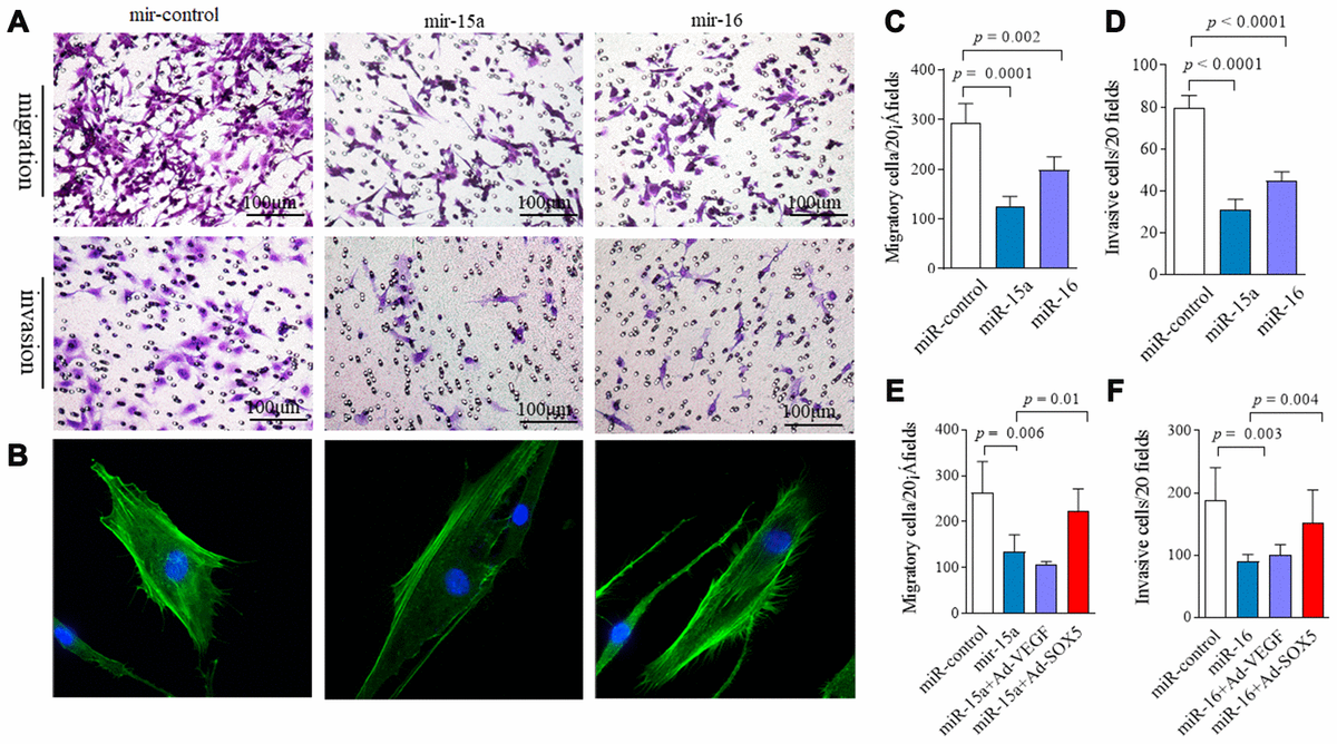 Microrna 15a16sox5 Axis Promotes Migration Invasion And Inflammatory Response In Rheumatoid 1602