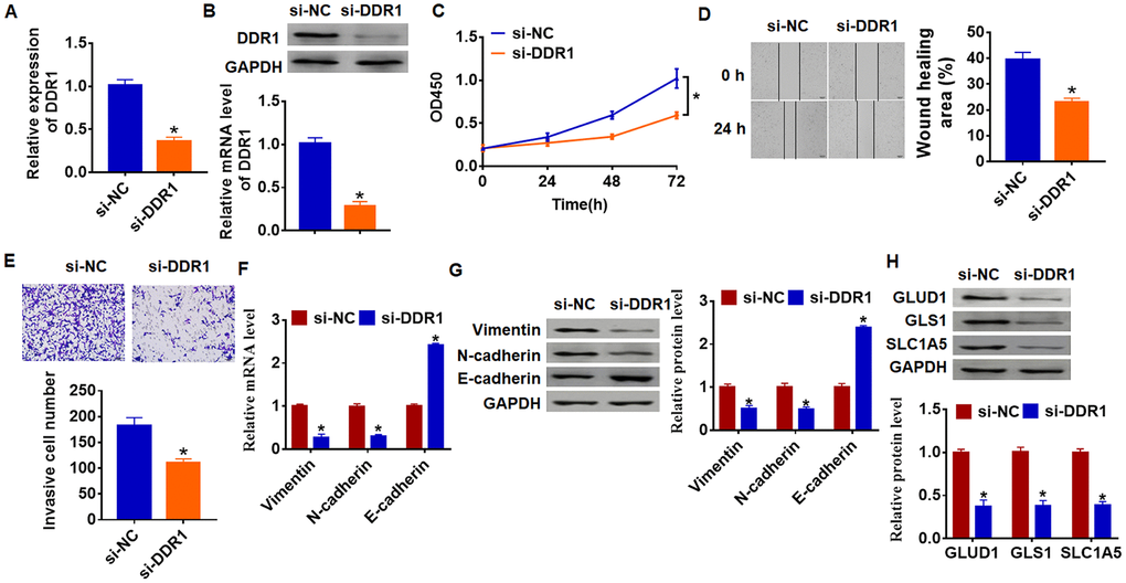 Loss of DDR1 inhibits EMT and glutamine metabolism in SNU-182 cells. The siRNA of DDR1 or NC was transfected into SNU-182 cells. The expression of DDR1 was detected by qRT-PCR (A) and western blot (B) (n = 6, *pC) CKK-8 assay was used to examine cell growth at 0, 24, 48 and 72 h (n = 10, *pD) Wound healing assay was used to detect cell migration (n = 6, *pE) Transwell assay was performed to check cell invasion (n = 6, *pF) and western blot (G) were used to test the expression of EMT related genes: Vimentin, N-cadherin and E-cadherin (n = 6, *pH) The protein expression of glutamine metabolism related genes: GLUD1, GLS1 and SLC1A was determined by western blot (n = 6, *p