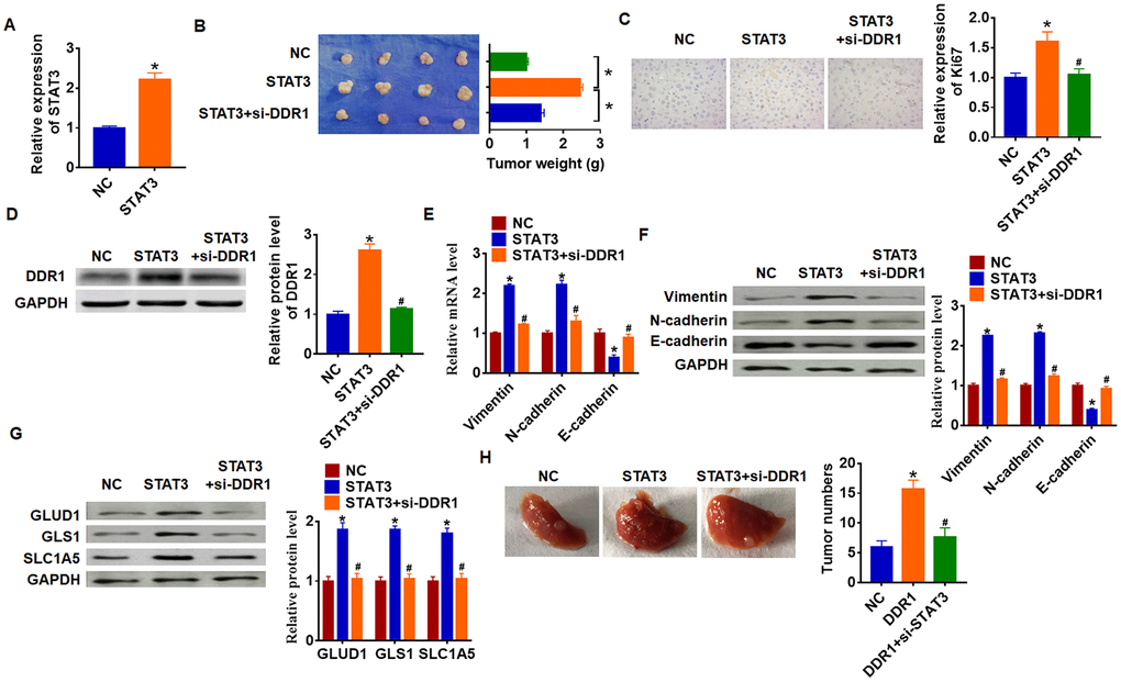 STAT3 promotes HCC development by increasing DDR1 in nude mice. Stable STAT3 or NC transfected SNU-182 cells were constructed (A) (n = 4, *pB) Tumor weight was calculated (n = 4, *pC) Immunohistochemical staining for Ki67 (n = 4, *pvs NC, #pvs STAT3). (D) Western blot analysis for DDR1 protein expression (n = 4, *pvs NC, #pvs STAT3). qRT-PCR (E) and western blot (F) for EMT related genes expression: Vimentin, N-cadherin and E-cadherin (n = 4, *pvs NC, #pvs STAT3). (G) Western blot analysis for protein expression of glutamine metabolism related genes: GLUD1, GLS1 and SLC1A (n = 4, *pvs NC, #pvs STAT3). (H) Stable STAT3 or NC transfected SNU-182 cells was intraperitoneally injected into mice, and lentivirus packaged si-DDR1 was injected into mice through tail vein 3 days later. Lungs were taken out and tumor numbers were calculated 4 weeks later.