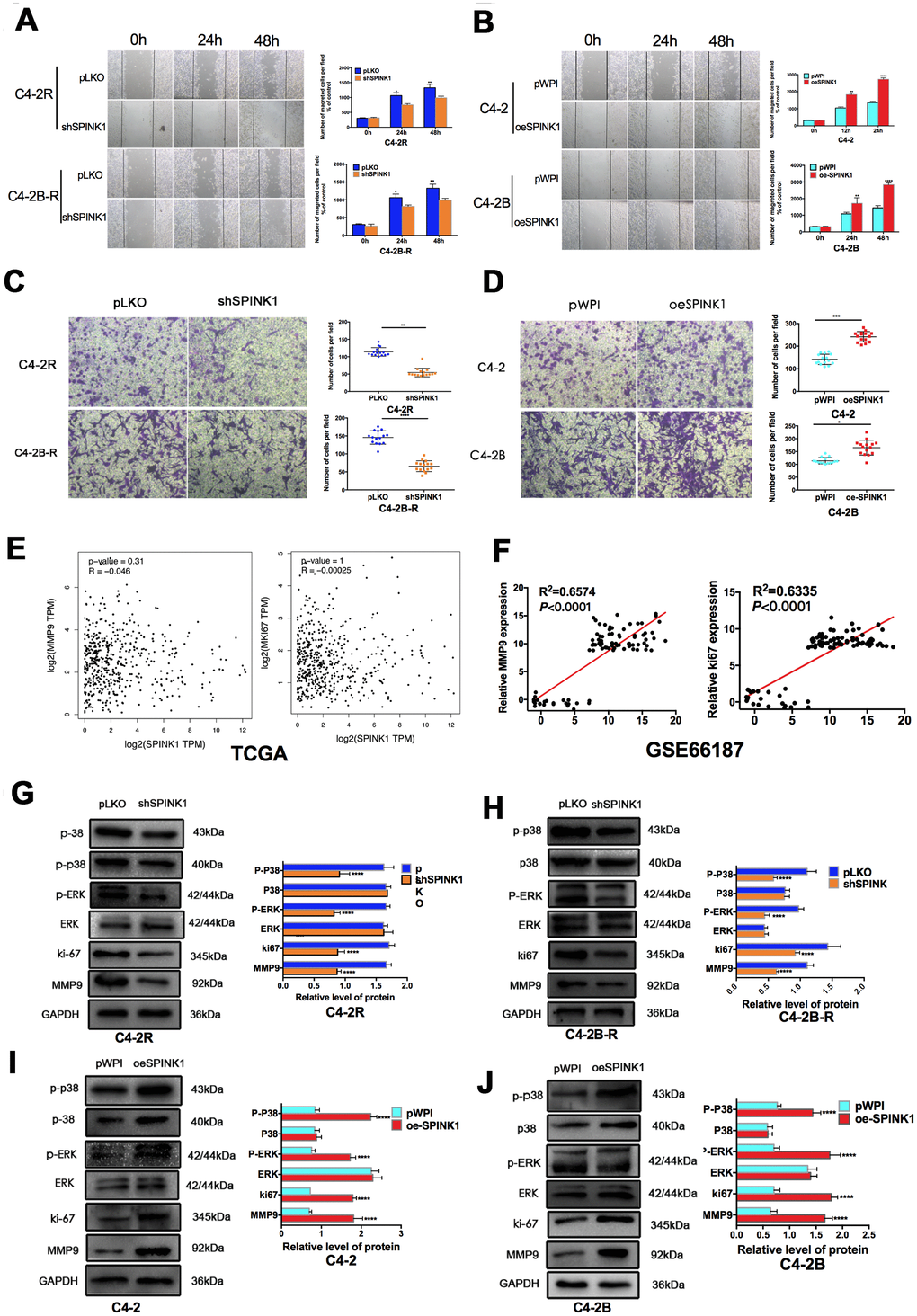 SPINK1 enhances migration and invasion of Enz-resistant cells via MAPK/MMP9 signaling. (A, B) Migration rates of shSPINK1 C4-2R and C4-2B-R cells, and oeSPINK1 C4-2 andC4-2B cells in the wound healing assay. (C, D) Invasive capacity of shSPINK1 C4-2R and C4-2B-R cells, and oeSPINK1 C4-2 and C4-2B cells in the transwell assay. (E, F) Correlation of SPINK1 expression with MMP9 and Ki67 levels in PCa tissues of TCGA and GSE66187 datasets. (G–J) Relative p-ERK, p-p38, Ki67 and MMP9 protein levels in shSPINK1 C4-2R and C4-2B-R cells, and oeSPINK1 C4-2 and C4-2B cells. Each bar represents the mean ± SEM, *P 