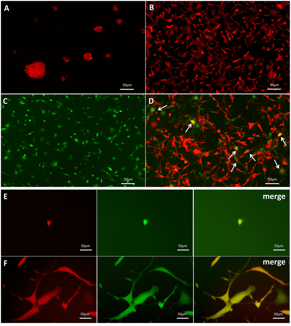 Dual-color fluorescence tracing of co-cultured SU4-RFPs and MSC GFPs, followed by mono-cloning of double-positive fluorescent cells. Stable expression of RFP in SU4 cells exhibiting (A) sphere-like or (B) adherent growth. (C) Expression of GFP in MSCs from GFP-Balb/c athymic nude mice. (D) RFP+/GFP+ cells (arrows) were observed in co-cultures of SU4-RFP and MSC-GFPs. (E) RFP+/GFP+ cells were mono-cloned from the co-cultures system and (F) subcultured.