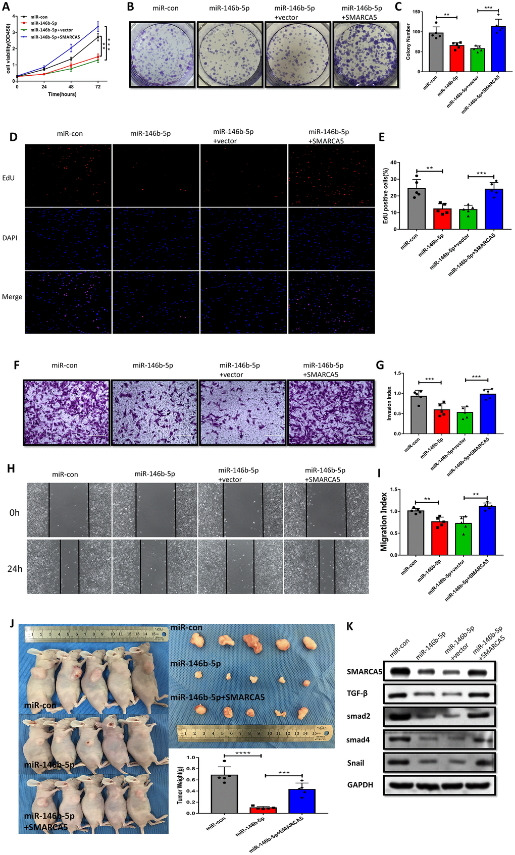 SMARCA5 restoration reverses miR-146b-5p-mediated inhibition of F GSC/MSC proliferation and metastasis. (A) CCK8, (B and C) colony formation, and (D and E) EdU assays were conducted to evaluate F GSC/MSC proliferation after transfection with miR-146b-5p alone or co-transfection with miR-146b-5p plus SMARCA5. (F and G) Transwell assays to assess the invasiveness of F GSC/MSCs transfected with miR-146b-5p alone or with miR-146b-5p plus SMARCA5. (H and I) Wound healing assays to assess migration of F GSC/MSCs transfected with miR 146b 5p alone or with miR-146b-5p plus SMARCA5. (J) Xenograft model for evaluation of tumorigenesis in vivo. (K) Western blot analysis of proteins in the TGF β pathway in F GSC/MSCs transfected with miR-146b-5p alone or with both miR 146b 5p and SMARCA5.