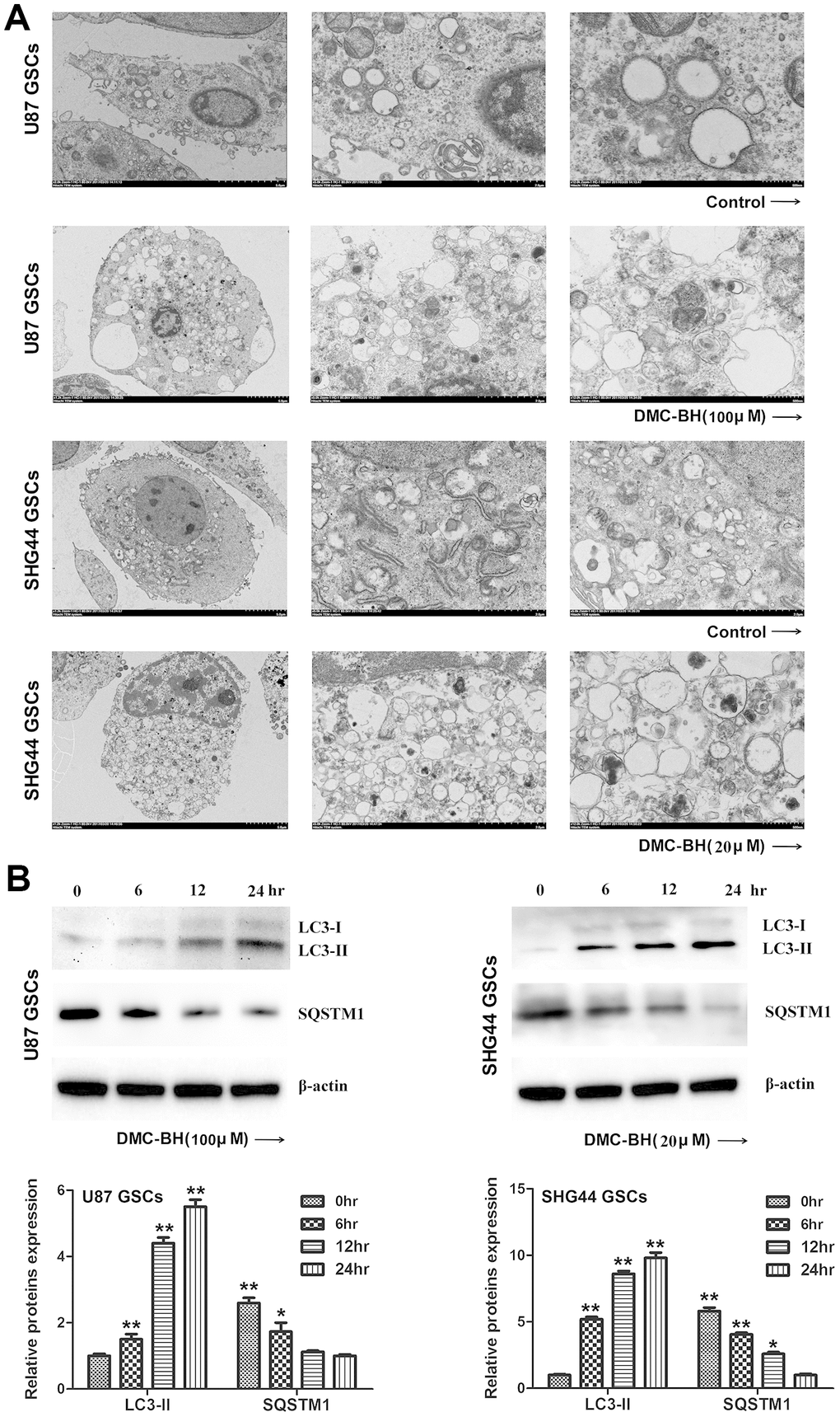 DMC-BH induces autophagy in GSCs. (A) Representative images of autophagosome formation in DMC-BH-treated U87 and SHG44 GSCs detected by TEM. (B) Levels of autophagy related proteins SQSTM1 and LC3 II measured in DMC-BH treated GSCs by western blotting.