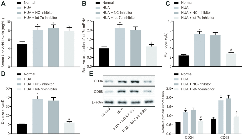 HUA increases let-7c expression to stimulate hemagglutination and thrombosis in mice. Normal mice were used as controls, and HUA mice were treated or not treated with NC-inhibitor or let-7c-inhibitor. (A) SUA in serum of mice detected using Urea Assay Kit. (B) Let-7c expression in serum of mice detected by RT-qPCR normalized to U6. (C) Fibrinogen level in serum of mice determined by ELISA. (D) D-dimer level in serum of mice determined by ELISA. (E) western blot analysis of CD36 and CD41 in platelets of mice normalized to β-actin. * p vs. normal mice. # p vs. HUA mice treated with NC-inhibitor. The measurement data were shown as mean ± standard deviation and compared by one-way analysis of variance, followed by Tukey's post hoc test. n = 10.