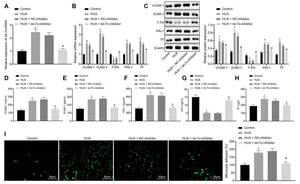 HUA-activated let-7c increases the expression of thrombus-related factors and the adhesion of monocytes and platelets to HUVECs. Normal HUVECs were used as controls, and HUA HUVECs were treated or not treated with NC-inhibitor or let-7c-inhibitor. (A) Let-7c expression in HUVECs. (B) VCAM-1, ICAM-1, PAI-1, TF, and T-PA expression in HUVECs determined by RT-qPCR normalized to GAPDH. (C) VCAM-1, ICAM-1, PAI-1, TF and T-PA expression in HUVECs determined by western blot analysis normalized to β-actin. (D) VCAM-1 level in HUVECs determined by ELISA. (E) ICAM-1 level in HUVECs determined by ELISA. (F) PAI-1 level in HUVECs determined by ELISA. (G) TF level in HUVECs determined by ELISA. (H) T-PA level in HUVECs determined by ELISA. (I) Adhesion of monocytes to HUVECs (× 200). * p vs. control HUVECs. # p vs. HUA HUVECs treated with NC-inhibitor. The measurement data were shown as mean ± standard deviation and compared by one-way analysis of variance, followed by Tukey's post hoc test. The cell experiment was repeated three times independently.