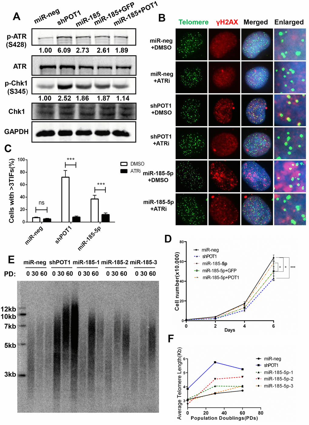 MiR-185 increases telomere dysfunction via the ATR signaling pathway in cancer cells. (A) ATR protein levels and phosphorylated Chk1 levels in POT1 knockdown, miR-185 overexpression and POT1 rescue HTC75 cells. Total Chk1 was blotted as a loading control. (B) After treatment with the ATR kinase inhibitor VE-821, the POT1 knockdown, miR-185 overexpression and control HTC75 cells were examined by immunostaining using anti-γ-H2AX antibody and fluorescence in situ hybridization using the TTAGGG telomere probe. (C) Quantification of the percentage of cells in (B) with more than 3 TIFs. Error bars indicate standard deviations (n=3). (D) Growth curve of HTC75 cells stably infected with viruses encoding empty vector (miR-Neg), shPOT1, miR-185, miR-185 plus GFP, or miR-185 plus POT1 at different time points. (E) Telomere restriction fragment (TRF) analysis showed the telomere length of HTC75 cells stably infected with the indicated viruses at the indicated population doublings (PD 0, PD 30, PD 60). (F) Quantification of telomere length in (E).