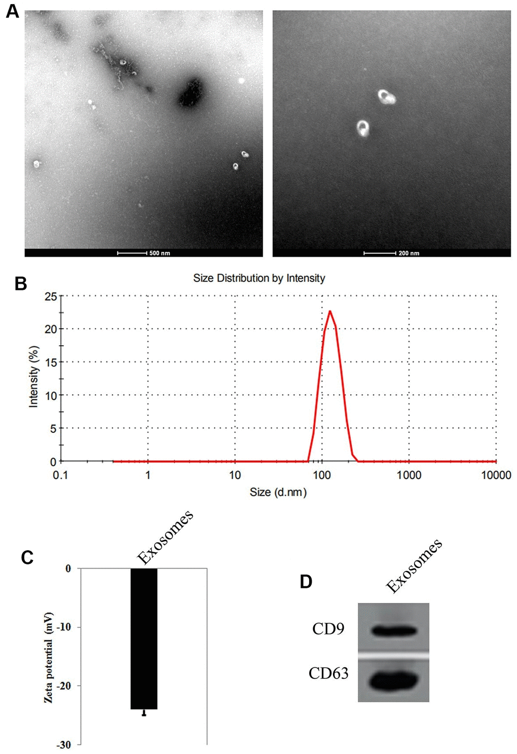 Identification of exosomes from Human umbilical cord derived mesenchymal stem cells (HUMSCs). (A) Observation of the shape and size of exosomes by transmission electron microscopy. (B) Measurement of the size of exosomes by dynamic light scattering. (C) Zeta potential of the exosomes. (D) The expression of CD9 and CD63, the surface markers of exosomes by Western blot.