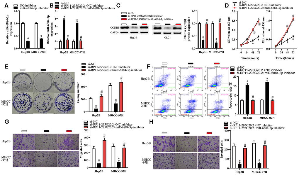 Inhibition of miR-6884-3p partially reverses the effects of RP11-295G20.2 silence on Hep3B and MHCC-97H cells. Hep3B and MHCC-97H cells transfected with the si-RP11-295G20.2 with NC inhibitor or miR-6884-3p inhibitor were subjected to the following assays. (A, B) RT-qPCR was used to detect the protein level of miR-6884-3p,*P C) Western blotting was used to detect the protein level of CCNB1,*P D–H) The CCK-8 assay, colony formation assay, cell apoptosis assay, and transwell migration and invasion assays were performed to test the proliferation, colony formation, apoptosis, migration, and invasion of Hep3B and MHCC-97H cells, respectively,*P 