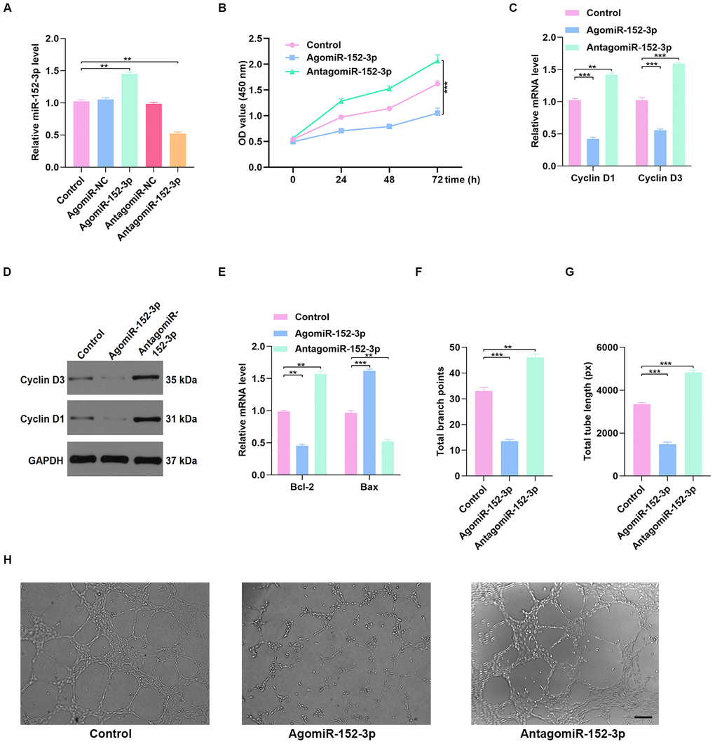 Inhibition of miR-152-3p enhanced HUVEC function. (A) The qRT-PCR result confirmed the effect of miR-152-3p agonist and antagonist on the expression of miR-152-3p. (B) CCK8 proliferation assay was performed, and the results demonstrated that proliferation of HUVECs was increased after miR-152-3p antagonist treatment. (C–D) The proliferation-related mRNAs in the different groups were measured using qRT-PCR and WB analyses. (E) The apoptosis-related mRNAs were assessed using qRT-PCR analysis. (F–H) Effects of miR-152-3p on the tube formation ability of HUVECs. Scale bar: 200 μm. Data are the mean ± SD of three independent experiments. *P 