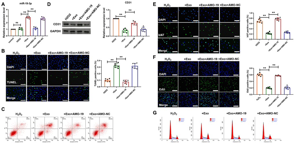 Downregulation of miR-19a-3p promotes endothelial cells survival and proliferation. (A) qRT-PCR analysis of miR-19a-3p level was measured in endothelial cells. U6 was used as the control. (B) TUNEL staining of endothelial cells after treatment of exosomes derived from CM-culture medium. (C) Flow cytometry was performed to detect apoptosis of endothelial cells. (D) Western blot analysis of expression level of CD31. (E) Immunofluorescence staining of ki67 in endothelial cells. (F) EdU staining in endothelial cells to show the effect of miR-19a-3p on proliferation of endothelial cells. (G) Flow cytometry was performed to detect cell cycle of endothelial cells. Exosome was derived from CM-culture medium. AMO-19 was transfected to inhibit the level of miR-19a-3p. **P 