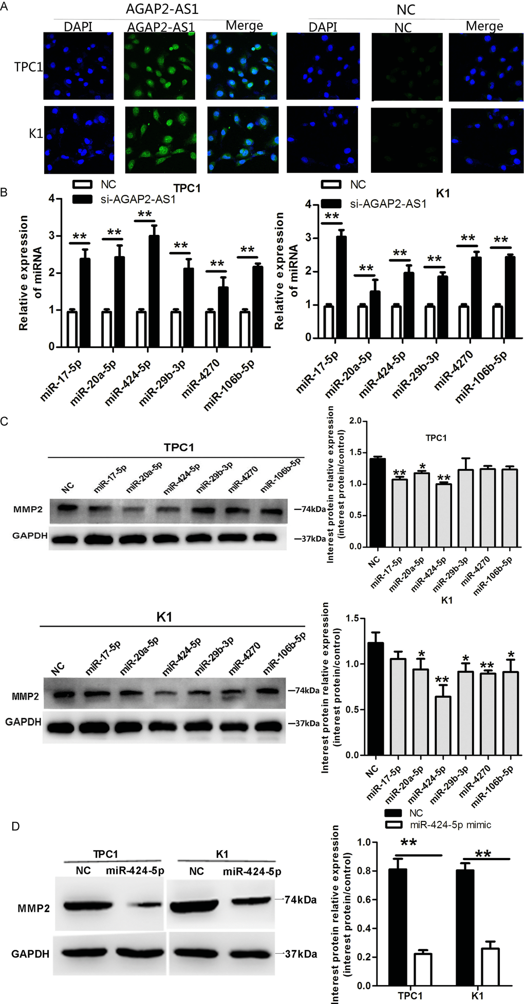 AGAP2-AS1 suppression decreases MMP2 expression by upregulating miRNA-424-5p in PTC cells. (A) FISH analysis demonstrating cytoplasmic localization of AGAP2-AS1 in TPC1 and K1 cells. (B) qRT-PCR of miRNAs in TPC1 and K1 cells after AGAP2-AS1 knockdown. Data are presented as the mean ± S.D, analyzed using an independent samples t-test; **P vs. NC. (C, D) Western blotting of MMP2 in TPC1 and K1 cells incubated with miR-424-5p mimic. Data are presented as the mean ± S.D, analyzed using an independent samples t-test; *P vs. NC.