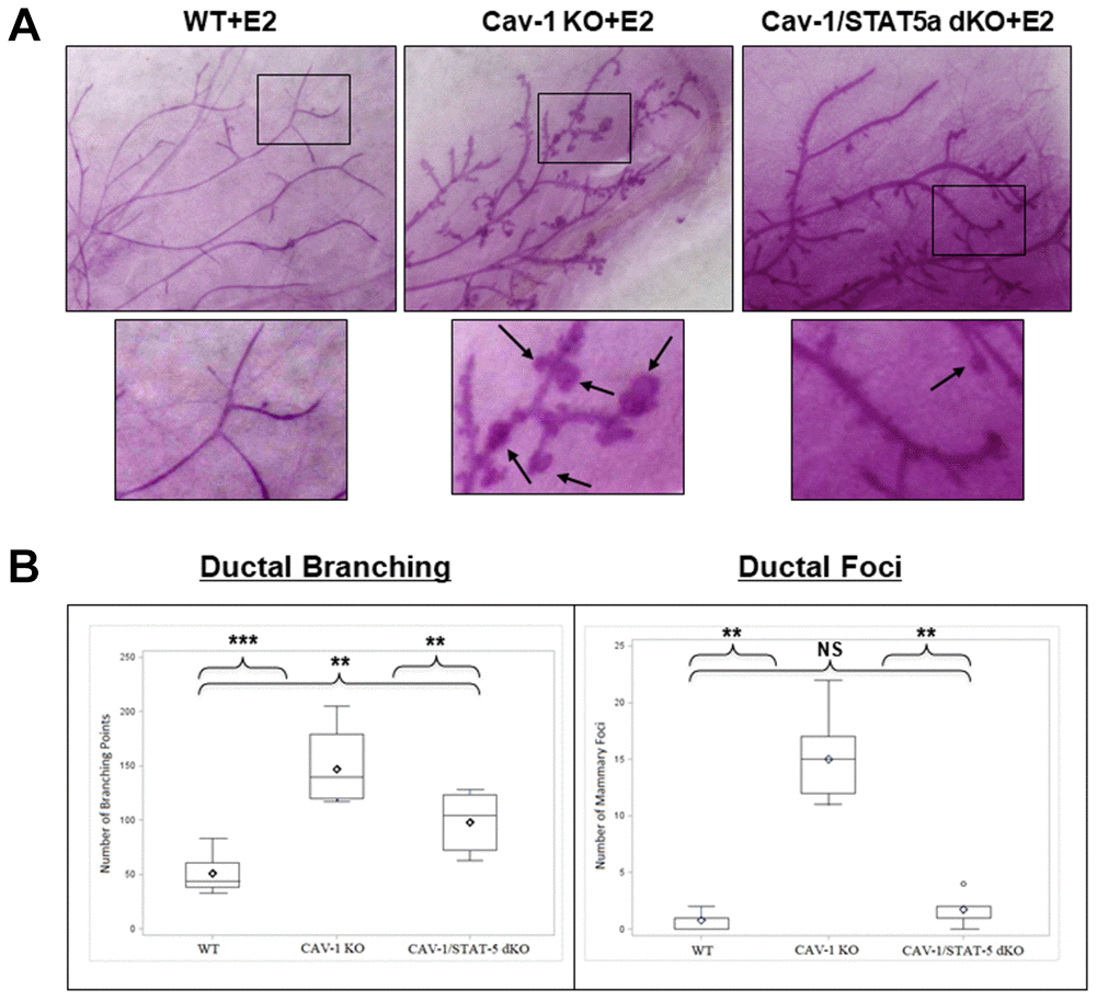 Deletion of STAT5a in Cav-1 KO mice prevents mammary branching and DCIS-Like Foci formation. (A) Mammary glands of estrogen-treated WT, Cav-1 KO, and Cav-1/STAT5a dKO mice were subjected to whole mount analysis to assess ductal branching and foci formation. Images of the mammary gland whole mounts were captured at 40x objective using an Olympus DP71 camera. Black arrows indicate mammary foci. Original cohort sizes were as follows: WT+E2 (9 mice); Cav-1 KO+E2 (7 mice); Cav-1/STAT5a dKO+E2 (8 mice). (B) SAS programming software (version 9.4) was used to generate box plots displaying the number of ductal branching points (left panel) and the number of ductal foci (right panel) for each experimental group. Ductal branching was calculated as a summation of primary, secondary, and tertiary branch points. The absence of STAT5a in the Cav-1 KO mammary gland led to a decrease in both ductal branching and foci formation. Quantitatively, changes in ductal branching were as follows (left panel): WT vs. Cav-1 KO (2.9-fold, p