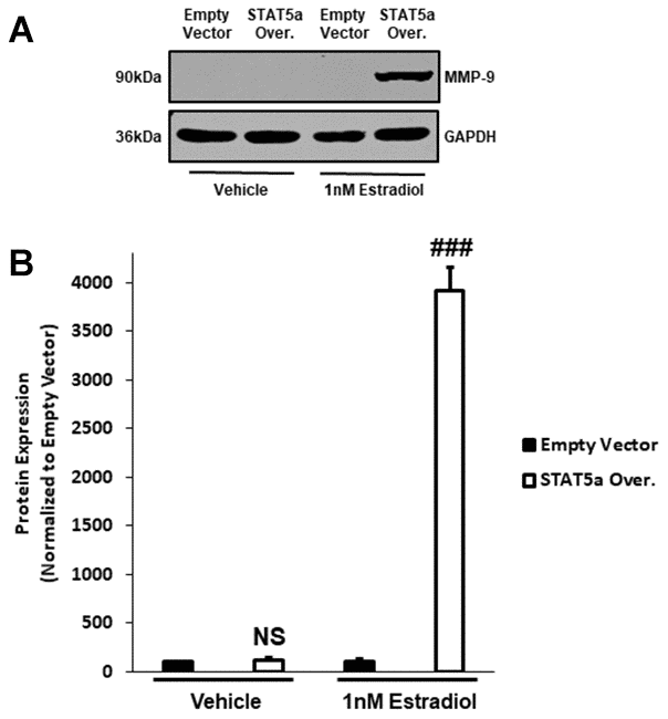 Pro-MMP-9 protein expression secondary to STAT5a overexpression and 17-β-Estradiol treatment suggest a hormonal regulation of DCIS progression with this transcription factor. (A) MCF10DCIS.com empty vector and STAT5a overexpressor cells were treated with vehicle (DMSO) or 1nM estradiol for 24 hours. Whole cell lysates (75μg) were used to assess the protein expression of MMP-9. GAPDH was used as a loading control. Western blotting was performed in triplicate on cells derived from 3 independent passages. (B) Using the LI-COR imager, densitometry was used to determine the protein expression of MMP-9 upon normalizing to the loading control. Data are reported as % empty vector. Quantitatively, no significant difference in MMP-9 expression was observed between vehicle-treated empty vector and STAT5a overexpressor cells (NS, p=0.382, n=3). Upon treatment with estrogen, a significant increase in MMP-9 protein expression was observed in STAT5a overexpressor cells compared to empty vector cells (39.1-fold, p