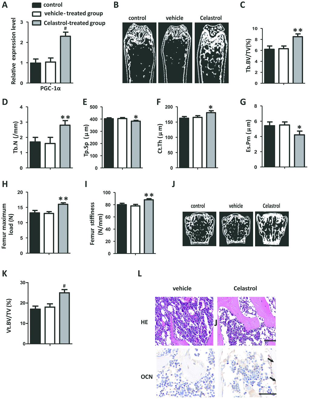 Administration of Celastrol alleviated bone loss and MAT accumulation in aged mice. (A) mRNA expression level of PGC-1α in the BM-MSCs determined using qRT-PCR (n = 3 per group). (B–G) Representative μCT images (B) and quantitative μCT analysis of trabecular (C–E) and cortical (F, G) bone microarchitecture in the femora of Celastrol-treated mice. n = 6-7 per group. (H–I) Three-point bending measurement of femur maximum load (H) and stiffness (I). n = 5 per group. (J, K) Representative μCT images (J) and quantification of the ratio of bone volume to tissue volume (K) of L4 vertebrae (Vt. BV/TV). n = 6 per group. (L) Representative images of H&E staining (L, top) and osteocalcin immunohistochemical staining (L, bottom). Scale bars: 100 μm. n = 5 per group. Data are presented as mean ± SD. Statistical significance was determined using analysis of variance (one-way ANOVA). #P **P *P 