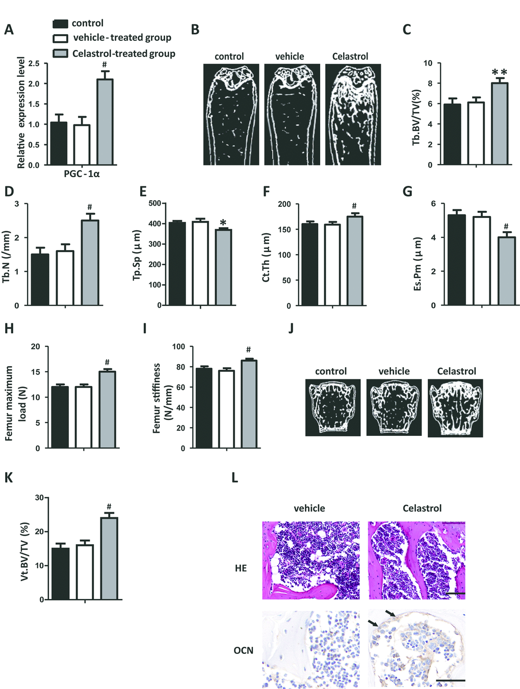 Celastrol treatment increased bone formation and reduced bone marrow fat in OVX mice. (A) mRNA expression level of PGC-1α in the BM-MSCs determined using qRT-PCR (n = 3 per group). (B–G) Representative μCT images (B) and quantitative μCT analysis of trabecular (C–E) and cortical (F, G) bone microarchitecture of the femora of Celastrol-treated mice. n = 6-7 per group. (H–I) Three-point bending measurement of femur maximum load (H) and stiffness (I). n = 5 per group. (J, K) Representative μCT images (J) and quantification of the ratio of bone volume to tissue volume (K) of L4 vertebrae (Vt. BV/TV). n = 6 per group. (L) Representative images of H&E staining (L, top) and osteocalcin immunohistochemical staining (L, bottom). Scale bars: 100 μm. n = 5 per group. Data are presented as mean ± SD. Statistical significance was determined using analysis of variance (one-way ANOVA). #P **P *P 