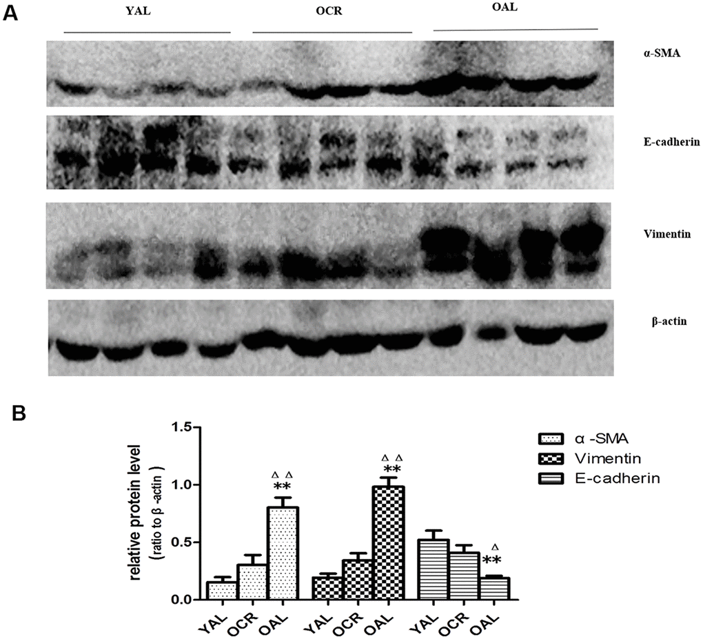 Expression of EMT biomarker in the kidneys of three groups. (A) Western blot results for α -SMA, E-cadherin, vimentin protein. (B) Quantitative analysis of band density for α-SMA,E-cadherin, vimentin protein. Data were presented as means ± SD (n=6). * p Δ pΔΔ p 