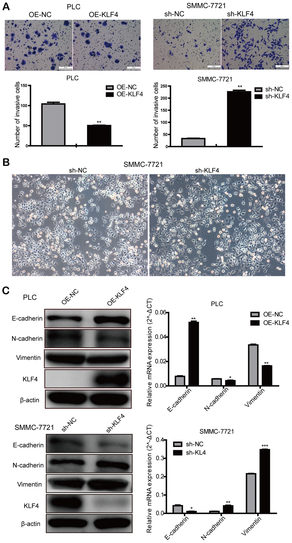 KLF4 inhibits the invasion of HCC cells. (A) Transwell assay was determined to detect the effect of KLF4 on cell invasion in PLC/PRF/5 and SMMC-7721 cells. Student’s t-test was used in bar charts. (B) Changes in cell morphology in SMMC-7721 with shKLF4. (C) Western blot and qPCR were used to detect EMT-associated protein expression in steadily transfected PLC/PRF/5 and SMMC-7721 cells. P P P P 