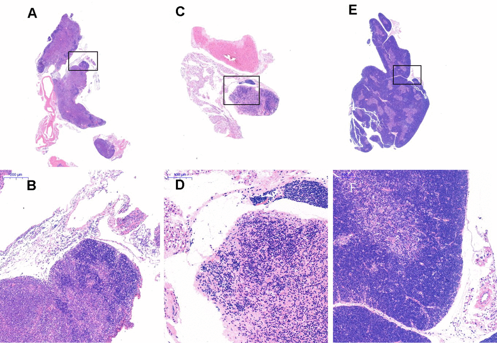 Thymus tissue structure changes. Note: (A, B) show the treatment group after 1 month (20×, 200×); (C, D) show the model control group (20×, 200×). The thymus tissue of the model control group was reduced in size and unclear; (E, F) show the young control group (20×, 200×).